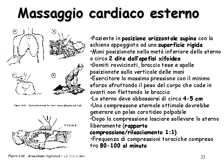 Massaggio cardiaco esterno • Paziente in posizione orizzontale supina con la schiena appoggiata ad