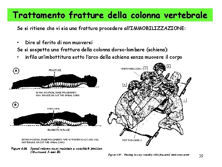 Trattamento fratture della colonna vertebrale Se si ritiene che vi sia una frattura procedere
