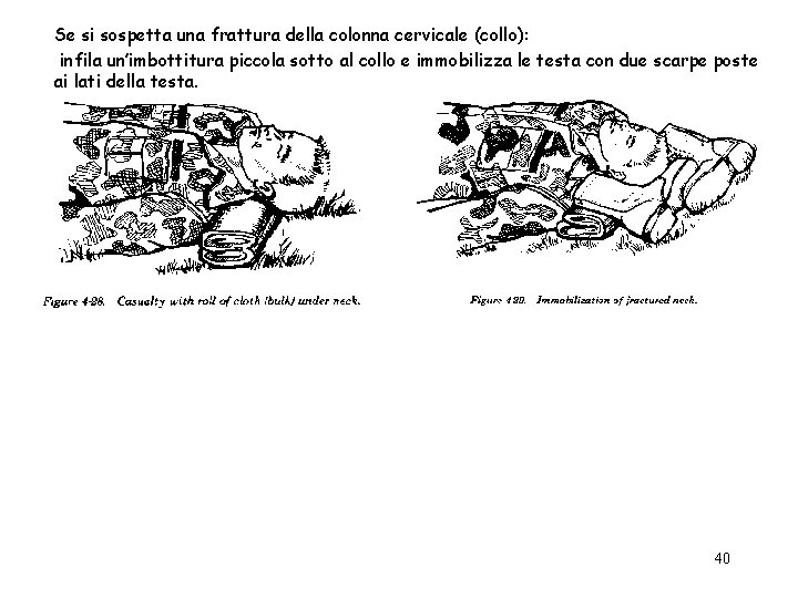 Se si sospetta una frattura della colonna cervicale (collo): infila un’imbottitura piccola sotto al