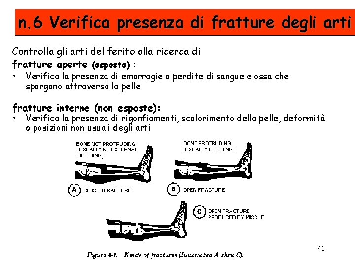 n. 6 Verifica presenza di fratture degli arti Controlla gli arti del ferito alla
