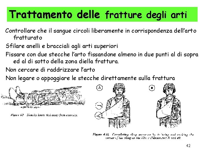 Trattamento delle fratture degli arti Controllare che il sangue circoli liberamente in corrispondenza dell’arto