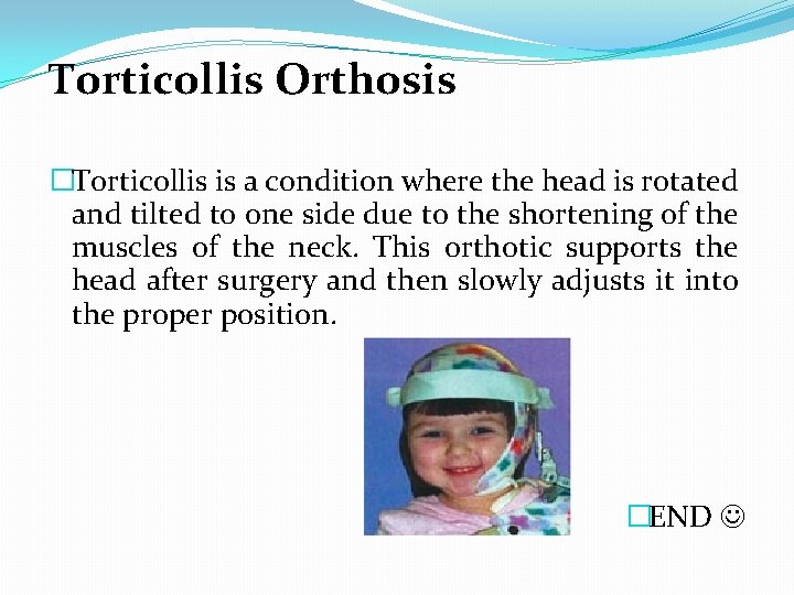 Torticollis Orthosis �Torticollis is a condition where the head is rotated and tilted to