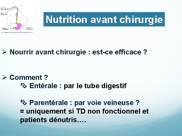 Nutrition avant chirurgie Ø Nourrir avant chirurgie : est-ce efficace ? Ø Comment ?