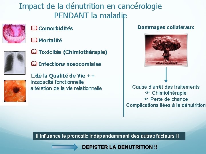 Impact de la dénutrition en cancérologie PENDANT la maladie Dommages collatéraux Comorbidités Mortalité Toxicités