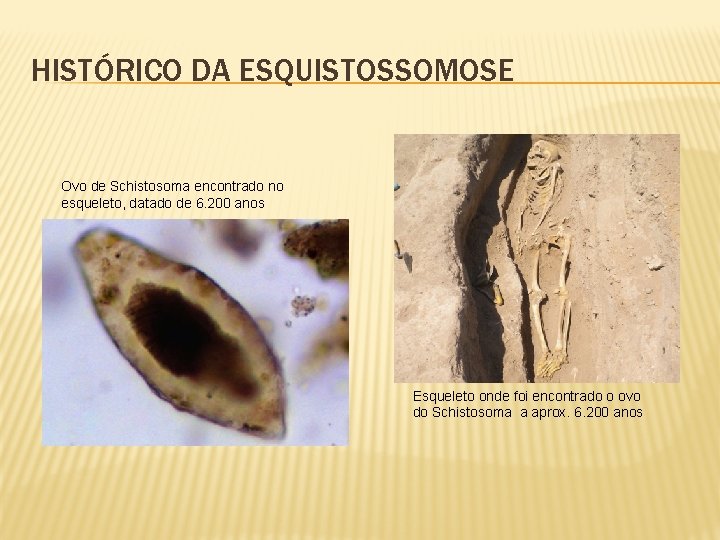 HISTÓRICO DA ESQUISTOSSOMOSE Ovo de Schistosoma encontrado no esqueleto, datado de 6. 200 anos