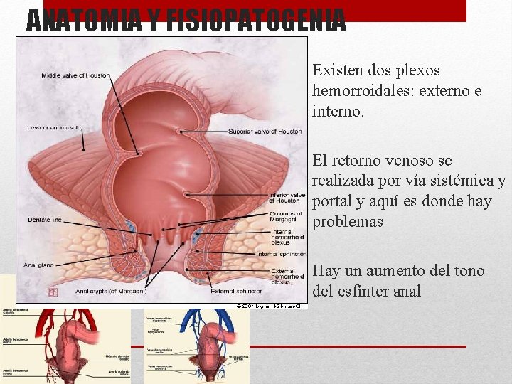 ANATOMIA Y FISIOPATOGENIA • Existen dos plexos hemorroidales: externo e interno. • El retorno