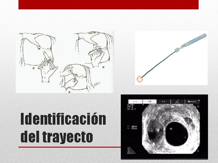 Identificación del trayecto 