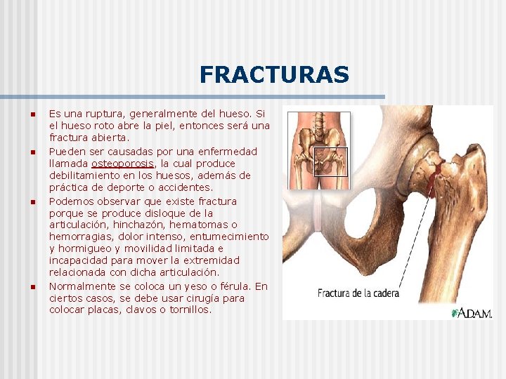 FRACTURAS n n Es una ruptura, generalmente del hueso. Si el hueso roto abre