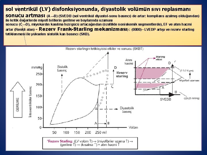 sol ventrikül (LV) disfonksiyonunda, diyastolik volümün sıvı replasmanı sonucu artması (A→B) (SVEDB (sol ventrikül