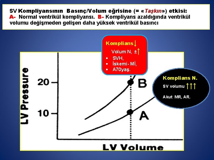 SV Kompliyansının Basınç/Volum eğrisine (= «Taşkın» ) etkisi: A- Normal ventrikül kompliyansı. B- Kompliyans