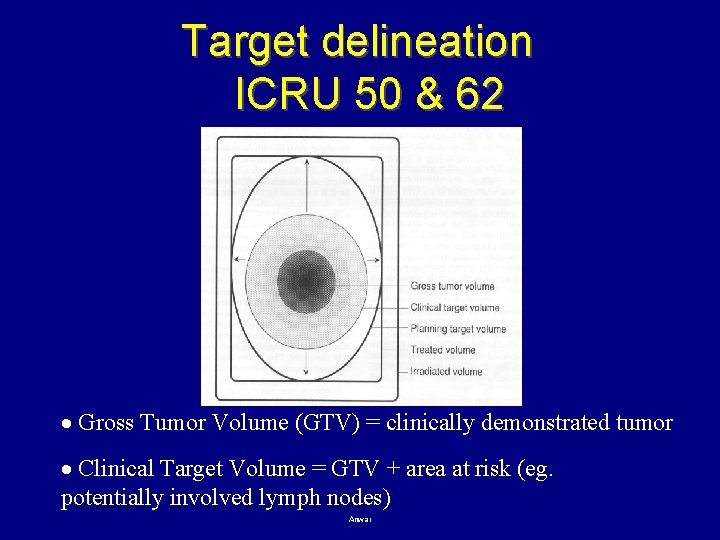 Target delineation ICRU 50 & 62 Gross Tumor Volume (GTV) = clinically demonstrated tumor