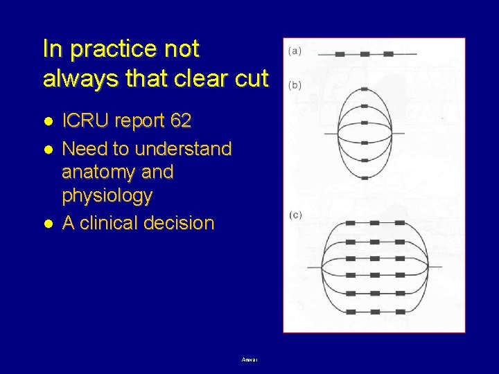 In practice not always that clear cut l l l ICRU report 62 Need