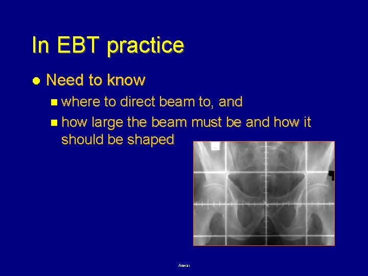 In EBT practice l Need to know n where to direct beam to, and
