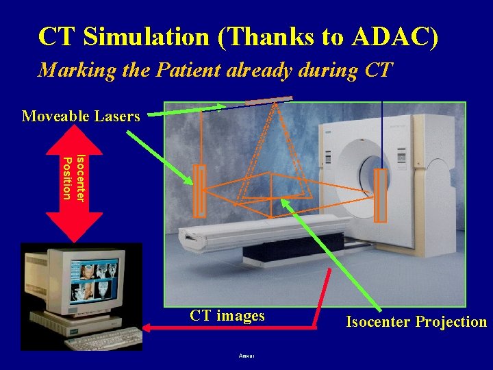 CT Simulation (Thanks to ADAC) Marking the Patient already during CT Moveable Lasers Isocenter