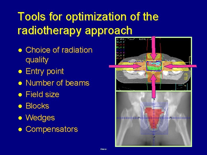 Tools for optimization of the radiotherapy approach l l l l Choice of radiation