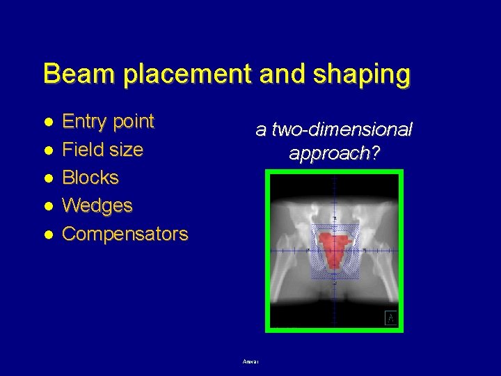 Beam placement and shaping l l l Entry point Field size Blocks Wedges Compensators