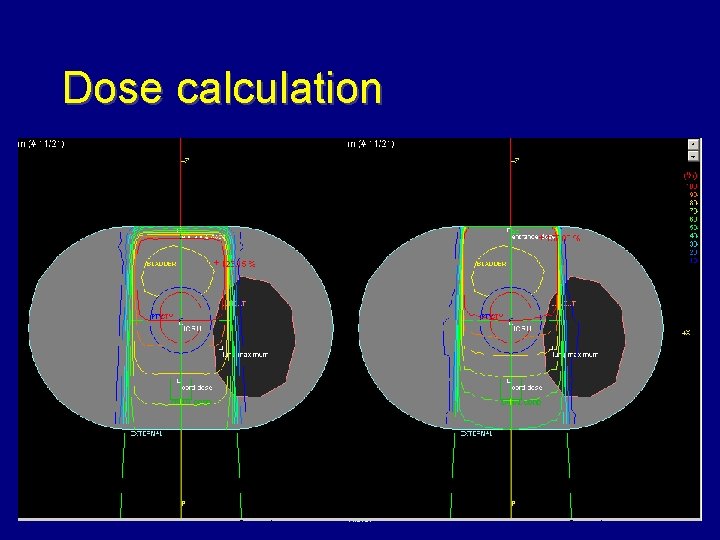 Dose calculation Anwar 71 