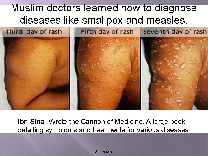 Muslim doctors learned how to diagnose diseases like smallpox and measles. Ibn Sina- Wrote Muslim doctors learned how to diagnose diseases like smallpox and measles. Ibn Sina- Wrote