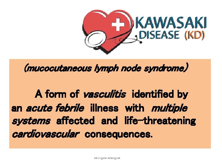 (mucocutaneous lymph node syndrome) A form of vasculitis identified by an acute febrile illness