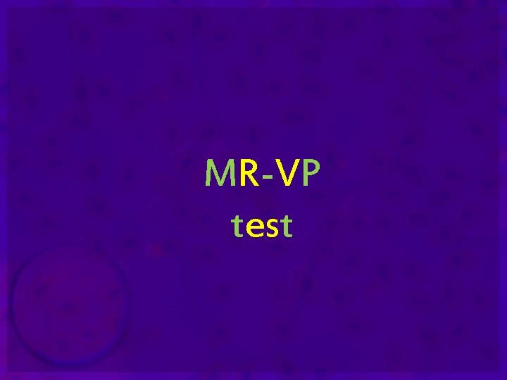 MR-VP test 