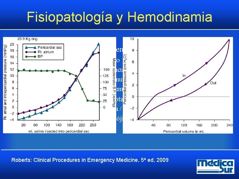 Fisiopatología y Hemodinamia • Determinantes de las consecuencias hemodinámicas Presión en el saco pericárdico Fisiopatología y Hemodinamia • Determinantes de las consecuencias hemodinámicas Presión en el saco pericárdico