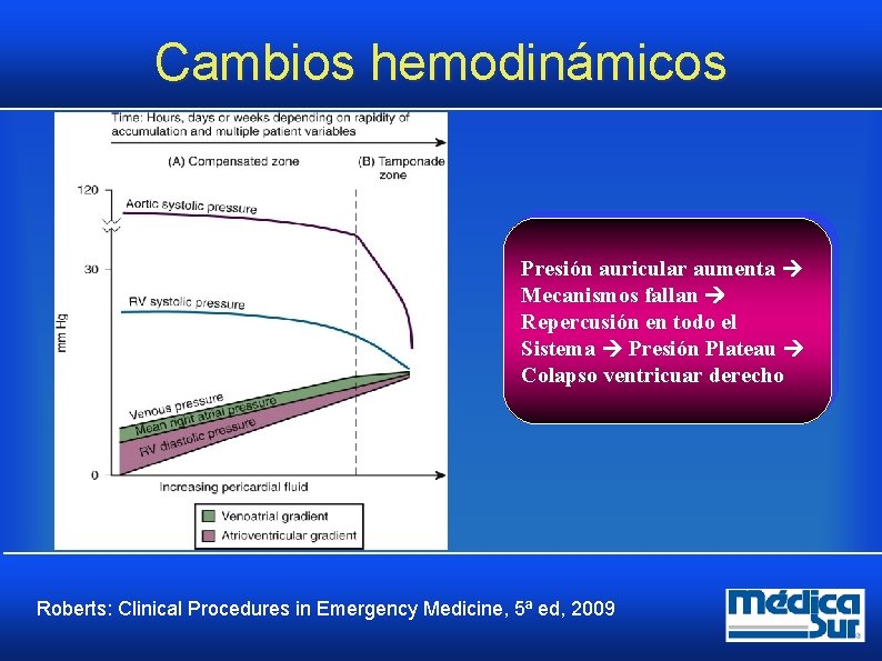 Cambios hemodinámicos Presión auricular aumenta Mecanismos fallan Repercusión en todo el Sistema Presión Plateau Cambios hemodinámicos Presión auricular aumenta Mecanismos fallan Repercusión en todo el Sistema Presión Plateau
