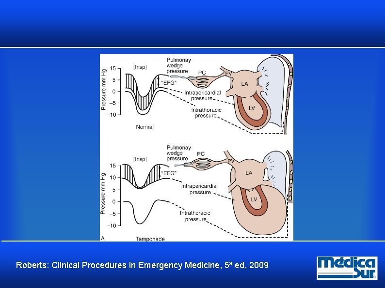 Roberts: Clinical Procedures in Emergency Medicine, 5ª ed, 2009 Roberts: Clinical Procedures in Emergency Medicine, 5ª ed, 2009