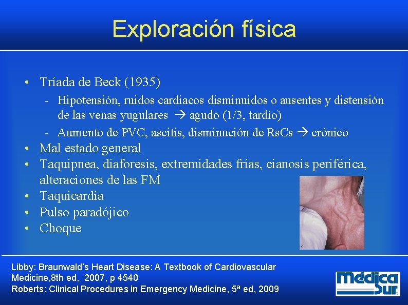 Exploración física • Tríada de Beck (1935) Hipotensión, ruidos cardiacos disminuidos o ausentes y Exploración física • Tríada de Beck (1935) Hipotensión, ruidos cardiacos disminuidos o ausentes y