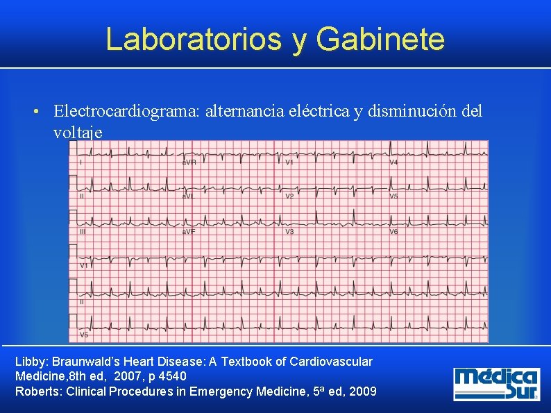 Laboratorios y Gabinete • Electrocardiograma: alternancia eléctrica y disminución del voltaje Libby: Braunwald’s Heart Laboratorios y Gabinete • Electrocardiograma: alternancia eléctrica y disminución del voltaje Libby: Braunwald’s Heart