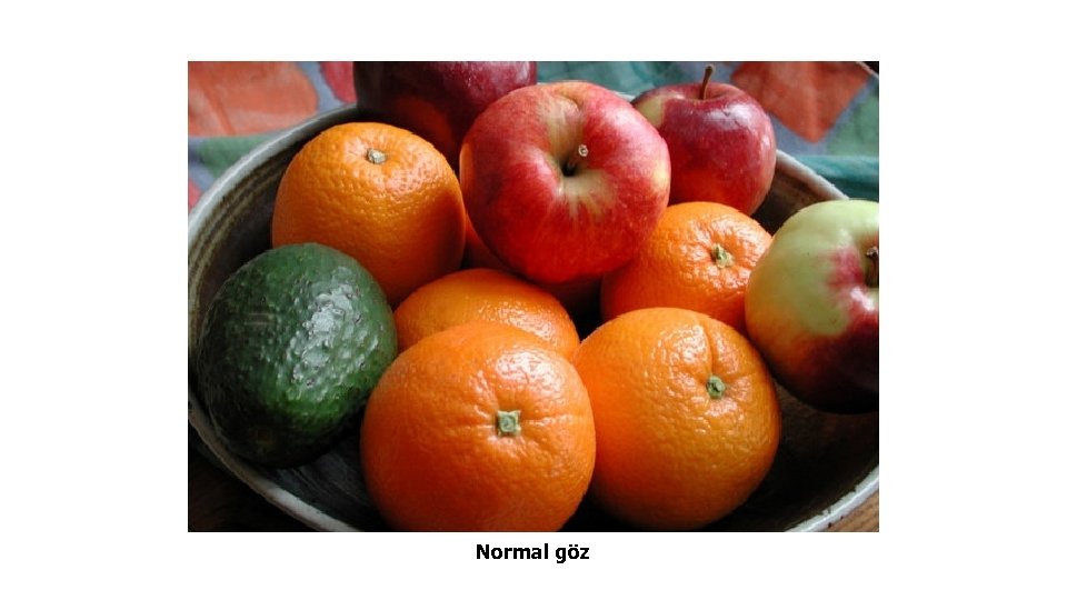 Normal göz 