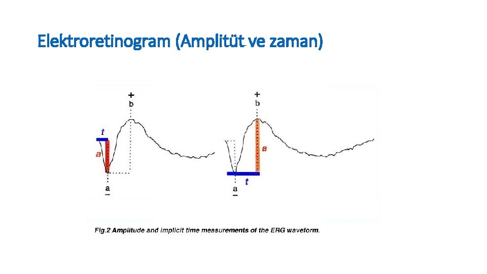 Elektroretinogram (Amplitüt ve zaman) 