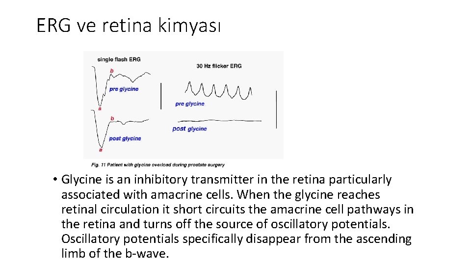 ERG ve retina kimyası • Glycine is an inhibitory transmitter in the retina particularly