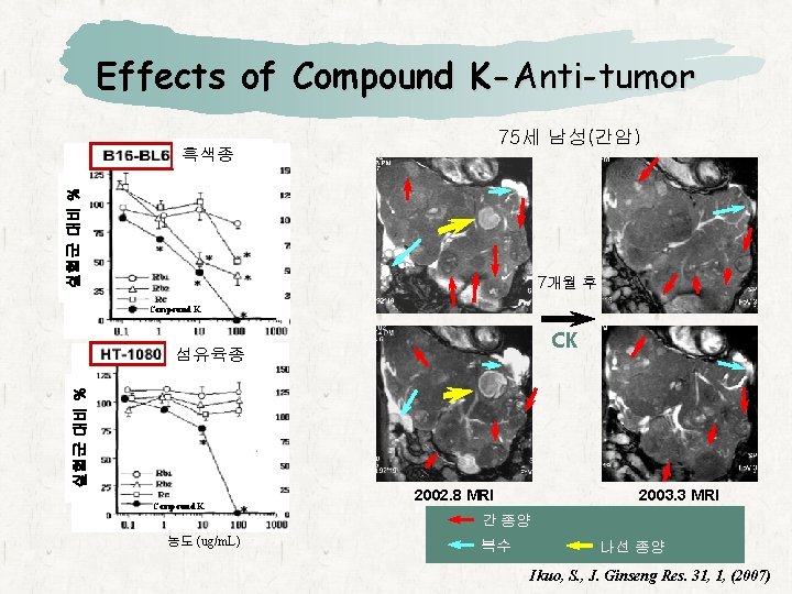 Effects of Compound K-Anti-tumor 75세 남성(간암） 실험군 대비 % 흑색종 7개월 후 Compound K