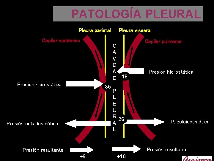 PATOLOGÍA PLEURAL Pleura parietal Capilar sistémico Presión hidrostática C A V D A D