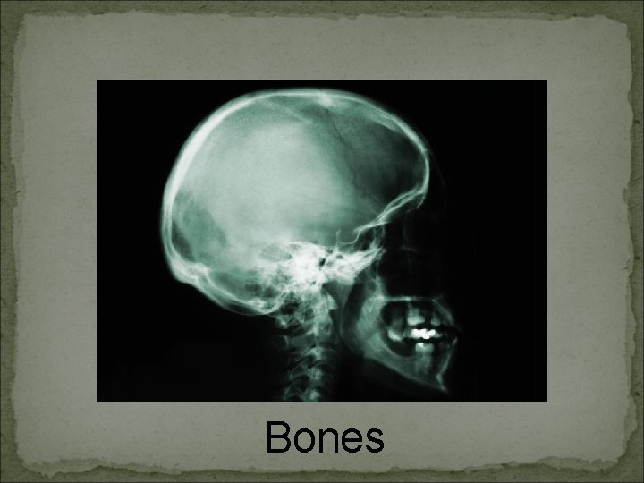 Bones 