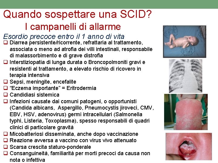 Quando sospettare una SCID? I campanelli di allarme Esordio precoce entro il 1 anno