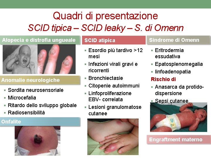 Quadri di presentazione SCID tipica – SCID leaky – S. di Omenn Alopecia e