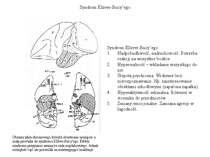 Syndrom Klüver-Bucy’ego 1. Nadpobudliwość, nadruchowość. Potrzeba reakcji na wszystkie bodźce. 2. Hyperoralność – wkładanie