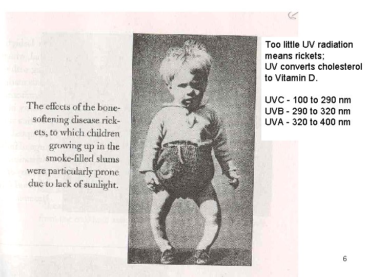 Too little UV radiation means rickets; UV converts cholesterol to Vitamin D. UVC -