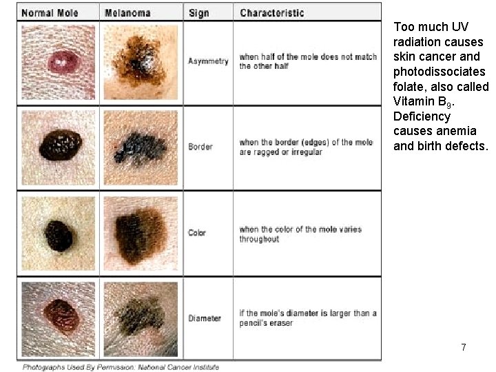 Too much UV radiation causes skin cancer and photodissociates folate, also called Vitamin B