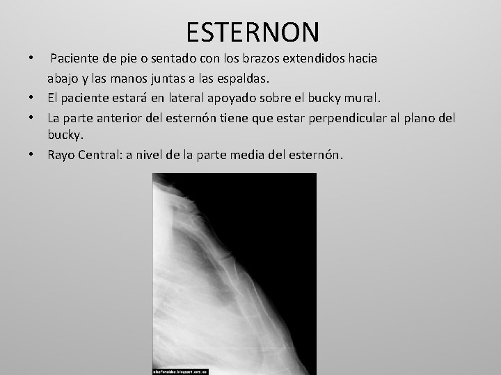 ESTERNON Paciente de pie o sentado con los brazos extendidos hacia abajo y las