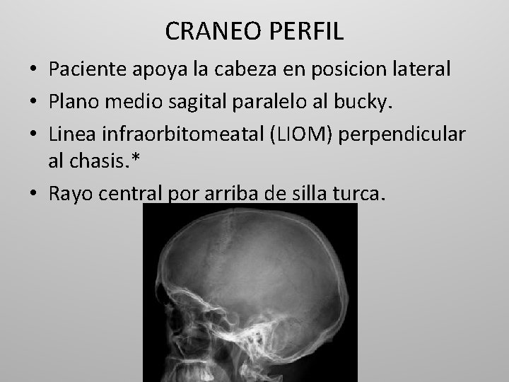CRANEO PERFIL • Paciente apoya la cabeza en posicion lateral • Plano medio sagital