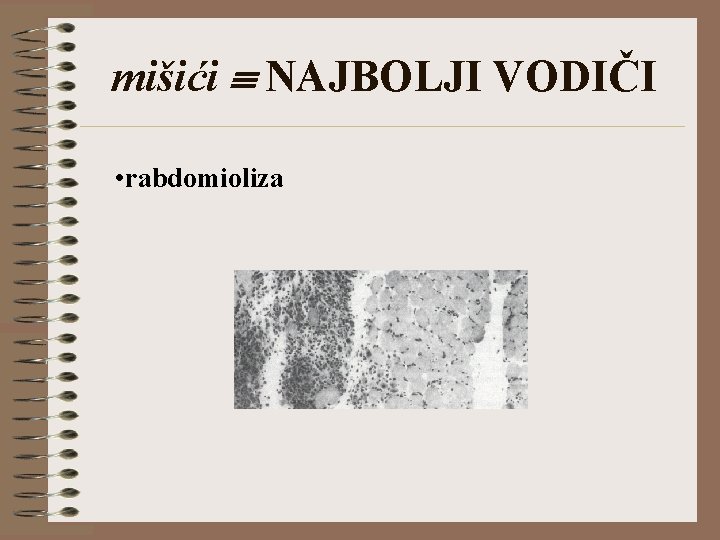 mišići NAJBOLJI VODIČI • rabdomioliza 