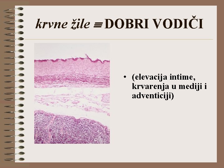 krvne žile DOBRI VODIČI • (elevacija intime, krvarenja u mediji i adventiciji) 