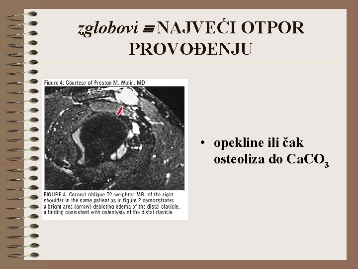 zglobovi NAJVEĆI OTPOR PROVOĐENJU • opekline ili čak osteoliza do Ca. CO 3 