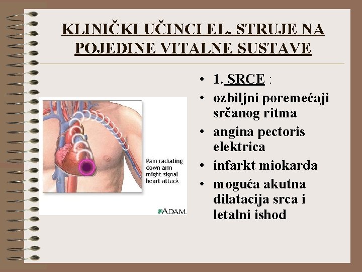 KLINIČKI UČINCI EL. STRUJE NA POJEDINE VITALNE SUSTAVE • 1. SRCE : • ozbiljni