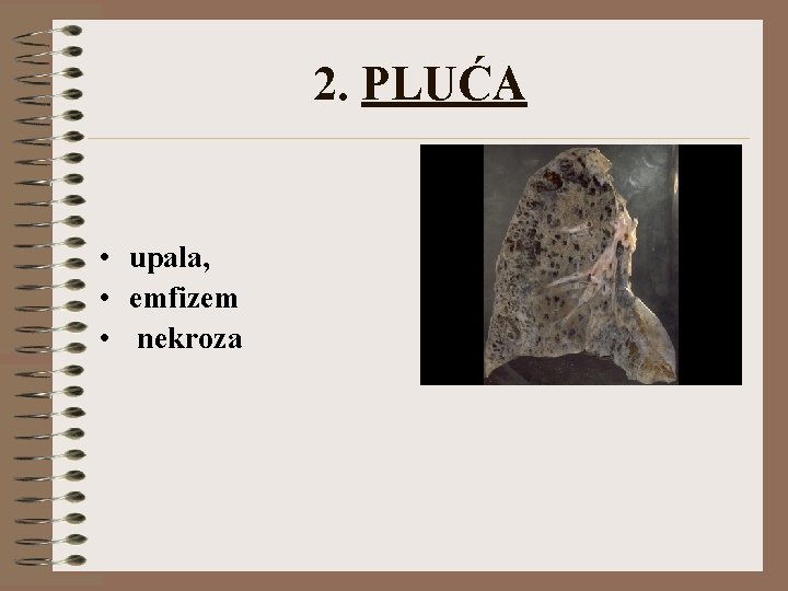 2. PLUĆA • upala, • emfizem • nekroza 