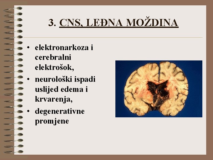 3. CNS, LEĐNA MOŽDINA • elektronarkoza i cerebralni elektrošok, • neurološki ispadi uslijed edema
