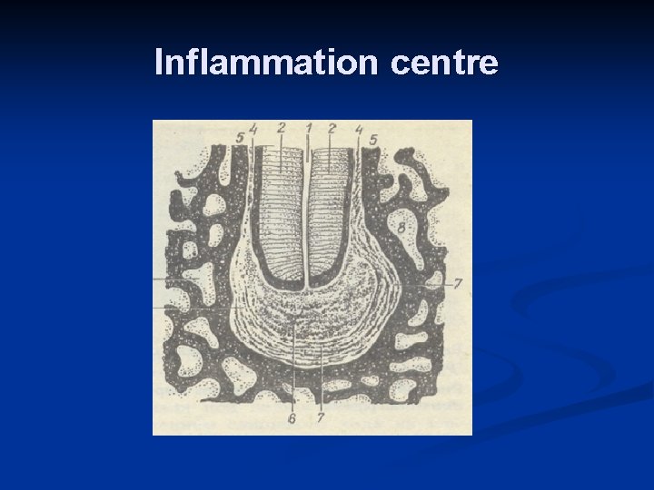 Inflammation centre 