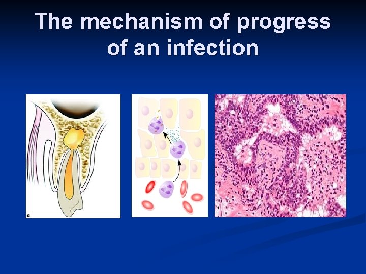 The mechanism of progress of an infection 
